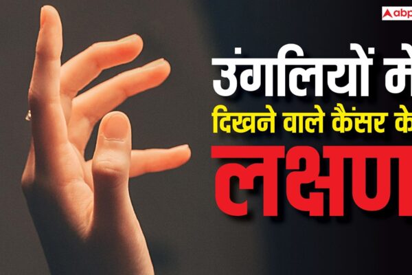आज की खबर: Early Signs of Lung Cancer: उंगलियों और नाखूनों में दिखते हैं लंग कैंसर के ये लक्षण, इन्हें गलती से भी न करना इग्नोर वरना हो जाएगी मौत