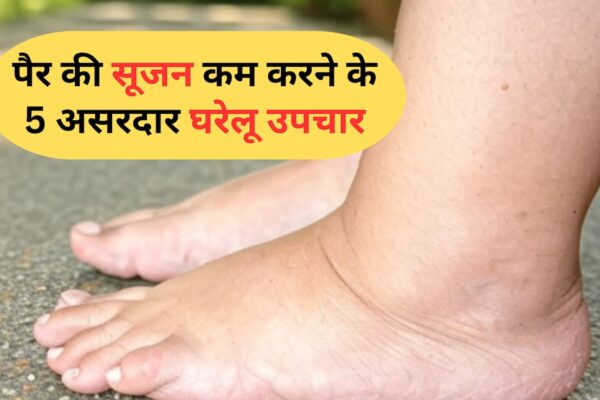 आज की खबर: घरेलू नुस्खा: लंबे समय तक खड़े रहने या बैठने से सूज जाते हैं पैर? इस नैचुरल तरीके से तुरंत Swelling होगी कम